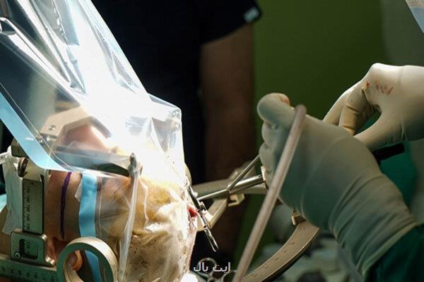 جراحی کاشت الکترود در مغز برای درمان صرع مقاوم به دارو انجام شد