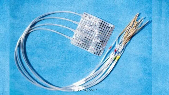 ردیابی خطاهای حرکتی با رابط مغز و کامپیوتر آسان تر می شود